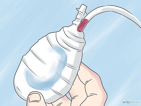 af84ae47a426030902b6d19f8aed5ef9